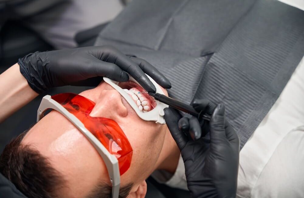 wybielanie zębów u dentysty